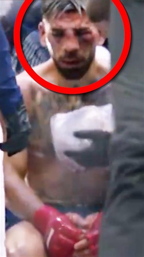 New Footage Of Ilia Topuria After His LOSS Just Surfaced! 😳 #UFC #MMA