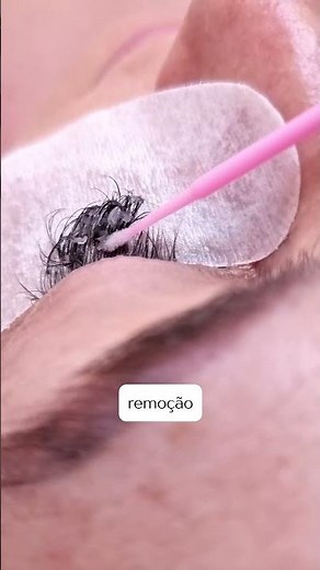 Remoção de cílios na prática