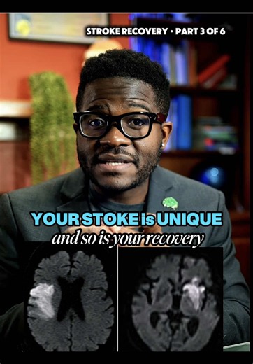 Why can one stroke take your speech and another take your balance? Because in the brain, location is everything. Part 3 of my stroke recovery series. A stroke is really an address — where it lands decides what you lose. Hit the left side and it can take language and the right half of the body. Hit the right side and it can take the left half — and sometimes the awareness that anything's wrong at all. Deep in the brainstem, a stroke smaller than a pea can affect breathing, swallowing, even leave 