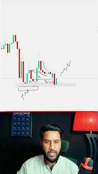Candlestick Reading Made Easy Learn To Read Any Chart #trading #learntrading #candlestickanalysis
