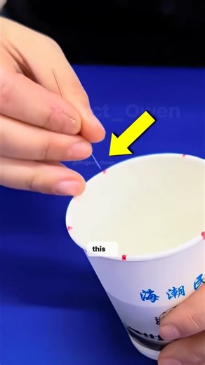 The Spinning Needle Technique in Acupuncture 🤯