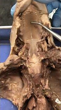 Human Body Systems Pig Dissection Demo