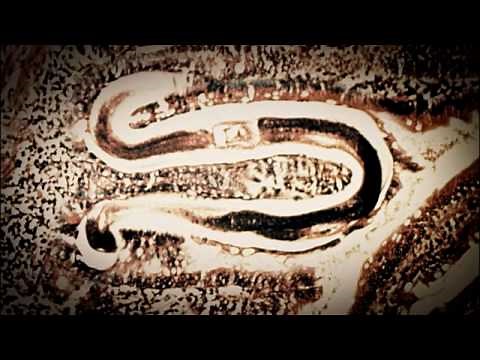 Deadly Bowel Worms