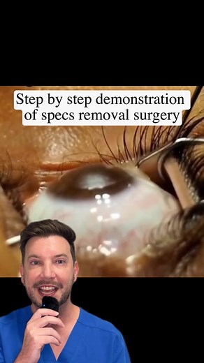 Understanding LASIK Eye Surgery Procedures