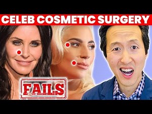 Doctor Reacts to Celebrity Plastic Surgery Fails - Dr. Anthony Youn