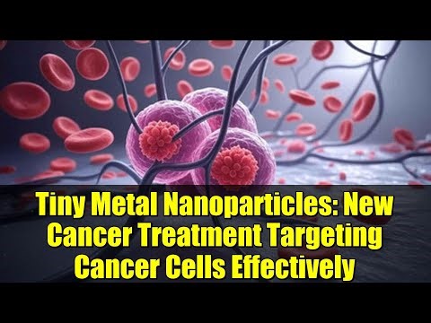 Tiny Metal Nanoparticles: New Cancer Treatment Targeting Cancer Cells Effectively