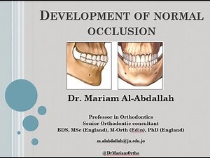Dr Mariam normal development of occlusion 1