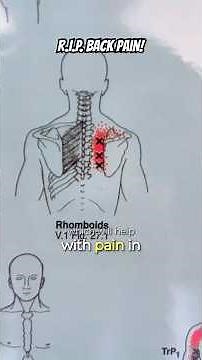 Fixing pain in the rhomboids