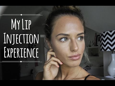 My Lip Injection Experience with Juvéderm | Mackenzie Salmon