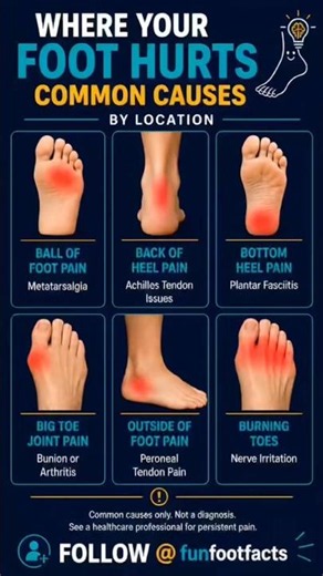 Where Your Foot Hurts 👣 Common Causes Explained