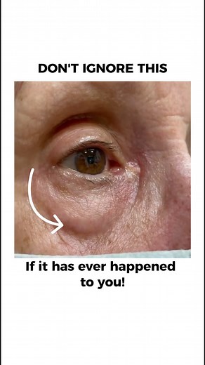 1.6M views · 2K reactions | Ever had your eyelid twitch nonstop and...