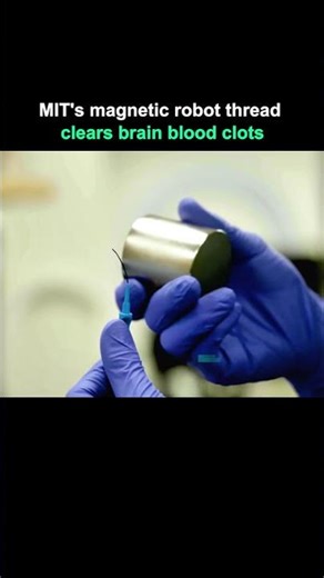 This Robotic Thread Removes Blood Clots in the Brain.