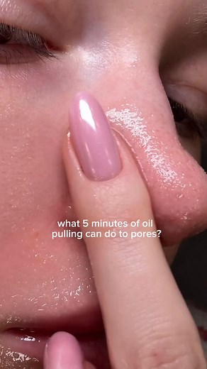 5.3K views · 5 comments | What 5 minutes of oil pulling can do to your pores? 﫣 #skin1004 #cleansing #cleansingoil #pores #blackheads #cleansingoil #oilpulling #cloggedpores | Alisha Cosmetics Collection | Facebook