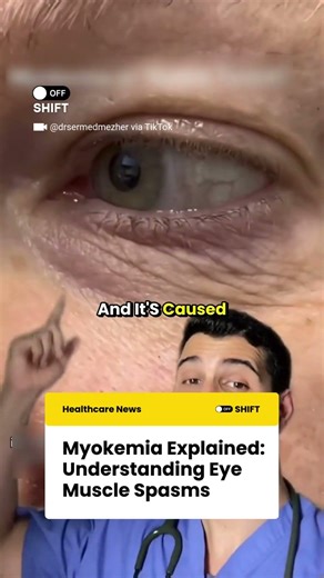 Eye Twitching Causes You Should Know