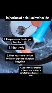 Sunday learning ! Excited for the week ahead if last week is anything to go by #calciumhydroxide #protip | Specialist Endo Sydney- Clinical hacks