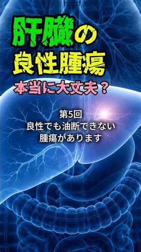 肝臓の良性腫瘍 本当に大丈夫？⑤ 「良性でも油断できない腫瘍があります」 #肝細胞腺腫 #肝臓 #消化器内科 #良性腫瘍 #健康診断 #肝臓の病気 #shorts