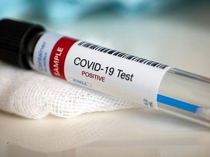 How Ohio Is Weathering Pandemic: See New Weekly Virus Data