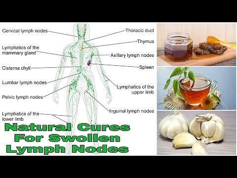 Natural Cures For Swollen Lymph Nodes