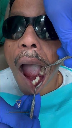 TITANIUM Dental - No Different from your Other Teeth! #dentist #dentalimplant #smile