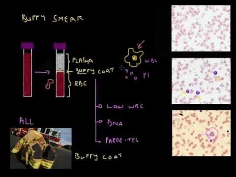 The Buffy Coat made easy - Full Blood Count Masterclass series