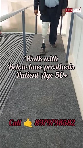 Below knee prosthesis l artificial limbs l Nakli Tang l Prosthetic leg #ottobock #ossur #hpsindia
