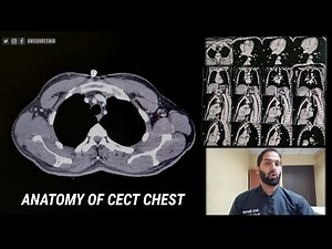 Anatomy of CECT CHEST | By Anis Qureshi