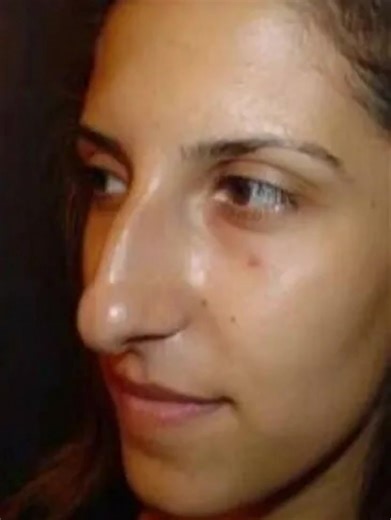 21K views · 33 reactions | “Before or after — which looks better?”  Nose surgery has changed lives, but these transformations left everyone speechless. Some say they finally feel confident, others argue natural beauty was better. See the before-and-after photos in the comments below  | Just About Interesting | Facebook