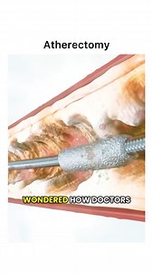 Animations on Instagram: "Follow @surgicalanimation for more! 🏥"