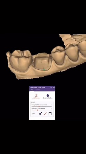 #dentaltechnology exocadofficial #dentalstudent # #dentaltechnican #dentallab #dentalassistant #dentalimplants# #dentalimplants #dentalcare #dentalhygiene #dentaldesign ##exocad_training #egypt #jordon #lebanon #iraq #طلبه_اسنان_الازهر #morroco #makkah #riyadh #jeddah #tunisia #albania #dental_student #unitedkingdom# #unitedstates #unitedarabemirates #united_dental_labor #tunisie #russia #unitedkingdom | Exocad training