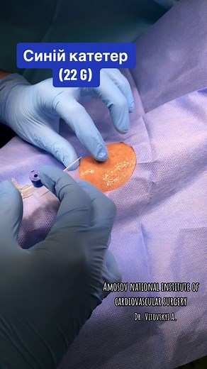 #catheterisation #dr_vitovskyi_andrii #cardiovascular #anesthesiology