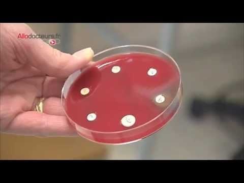 Stomach aches: the hunt for Helicobacter pylori - Allô Docteurs