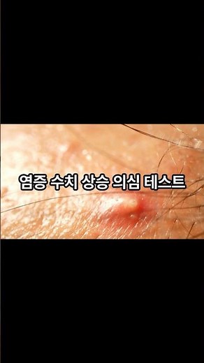 염증 수치 상승 의심 테스트검사 전, 몸이 먼저 알려주는 신호 #건강정보 #이슈 #올바른정보