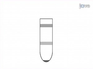 Isolation of Brain-infiltrating Leukocytes