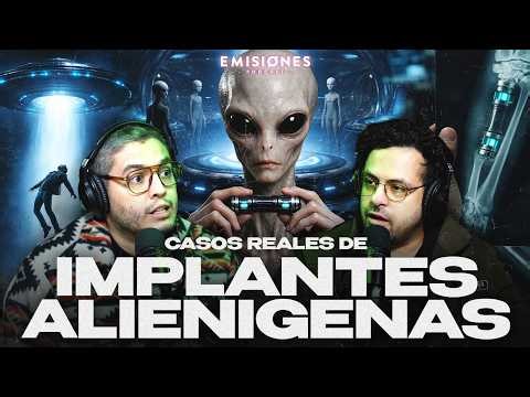 CASOS REALES de IMPLANTES ALIENÍGENAS