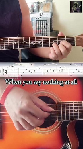 172K views · 2.8K reactions | When you say nothing at all #everyonehighlights | Guitar intro ni Kuya Jojo | Facebook