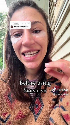 Healthy Teeth: Benefits of Tooth Powder for Sensitivity