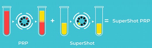 What Is Supershot PRP? - Regenexx