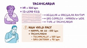 Video: Approach to tachycardia: Clinical sciences - Video Explanation! | Osmosis | Osmosis