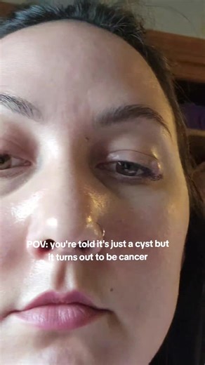 I've had two surgeries since this video was taken & I'm about to have my third. 🫠 #cancer #carcinoma #eyelidsurgery