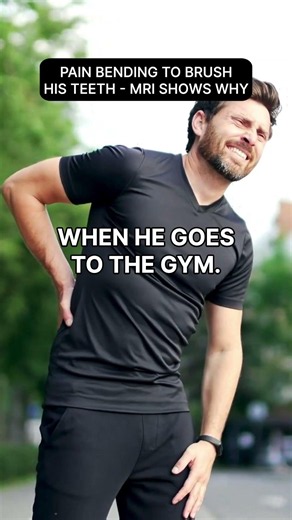 Why Hamstring Stretches Can Worsen Sciatica & How to Relieve Nerve Pressure #Sciatica #BackPain