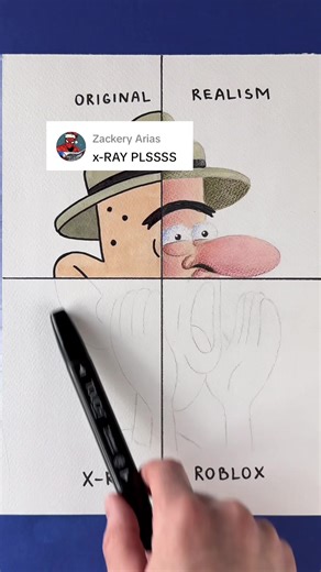 City boy in X-ray! #cityboy #xray #meme #TechTips #tiktoklearningcampaign