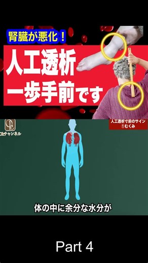【腎臓が悪化】人工透析寸前のサインや症状と腎臓病の予防法_Part_4