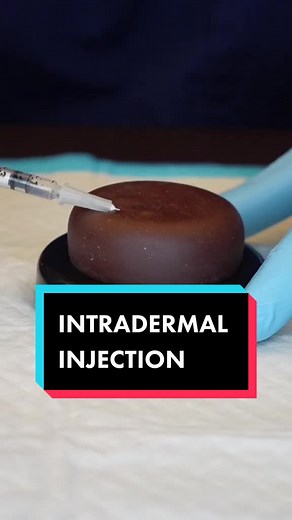 Practice an intradermal injection with us on the Pocket Nurse Demo Dose® Dark Inject-Ed! 💉 #intradermalinjection #intradermal #intradermalshot #tbtest #tbtesting #nursingstudent #nursingschool #schoolnurse #nurseeducator #medicationadministration #askanurse #nursesoftiktok #ijustwannarock #appreciatenurses #nurseinthemaking #nurseinjector #skintones #diversity #diversityinmedicine #diversityinhealth #diversityinhealthcare #justnursethings #satisfying #injectiontok #medtok #skillslab #medicalass