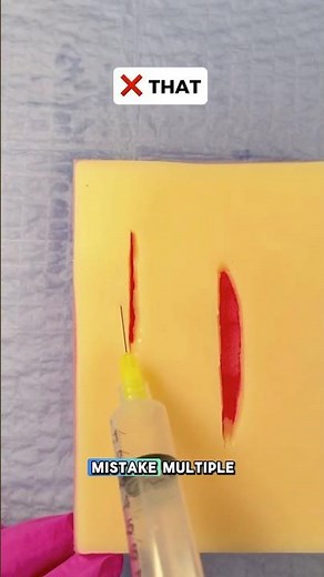 Less Pain vs More Pain: Local Anesthetic 💉#pastudent #npstudent #howtostitch #howto #syringe