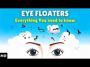 Eye Floaters – Causes, Signs and Symptoms, Diagnosis & Treatment