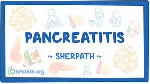 Case study - Pancreatitis: Nursing: Video & Causes | Osmosis