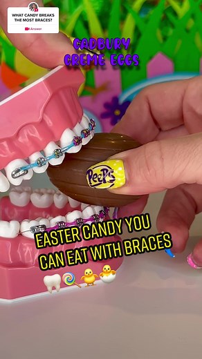 Best Candy for Braces: A Comprehensive Guide