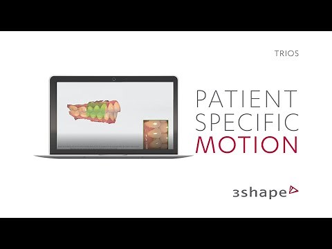 3Shape TRIOS - Patient specific motion