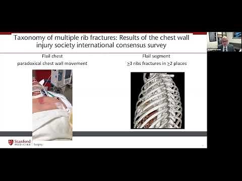 "Surgical Management of Chest Wall Injury" presented by Dr. Joseph Forrester