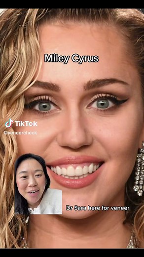 Miley Cyrus Veneers Transformation: Before & After
